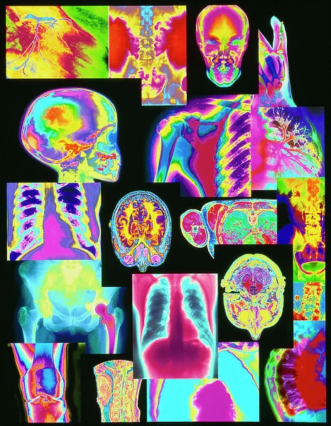Assortment of coloured X-rays and body scans