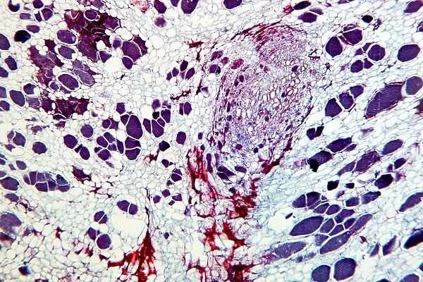 Clubroot infection, light micrograph