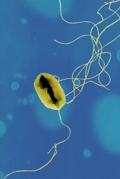 E. coli bacteria strain O157: H7, TEM