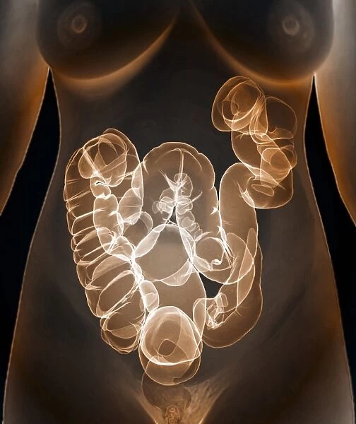 Healthy large intestine, 3D CT scan C016  /  6507