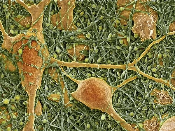 Nerve cells and glial cells, SEM