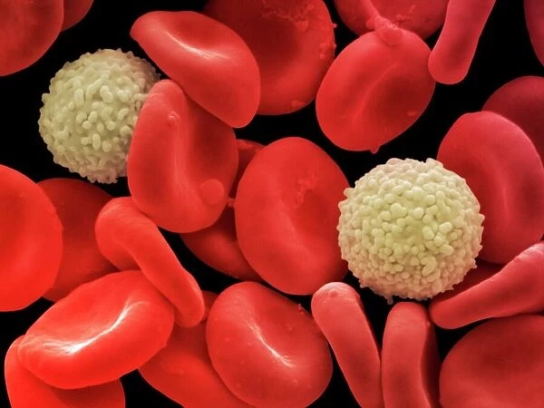 Red and white blood cells, SEM