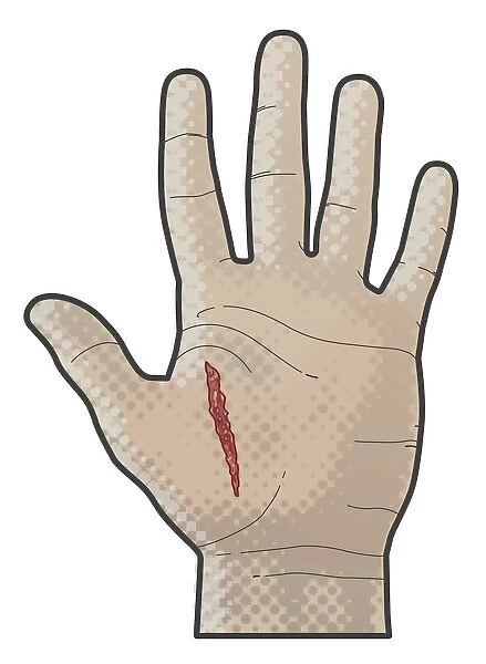 Digital illustration of incised wound on palm human hand