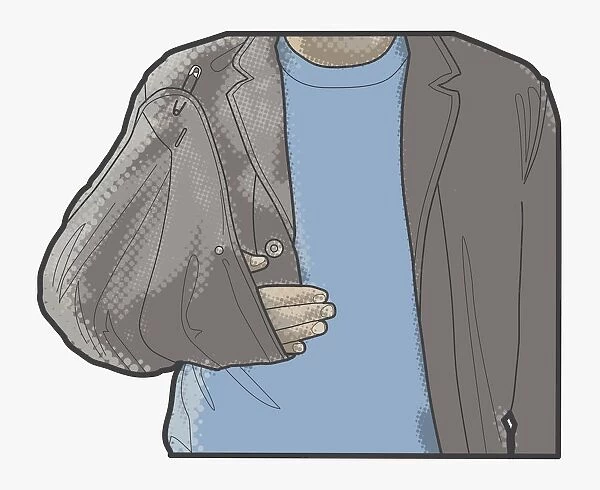 Digital illustration of man using jacket corner as sling