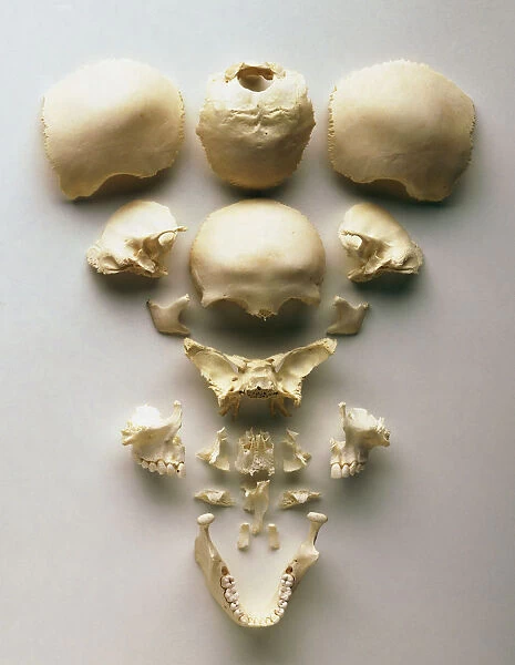 Human skull separated into its individual bones, including front, cheek, concha, vomer, nasal and jaw bones