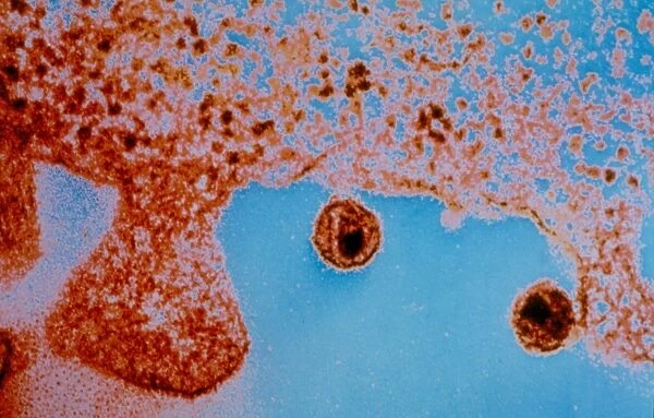 Image of Aids virus