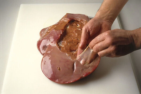 Peeling off the outer membrane of liver, using fingers, close-up