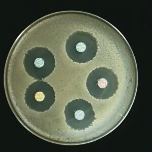 Anthrax antibiotics research