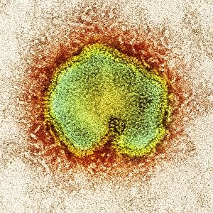 Avian influenza virus, TEM C015 / 8799