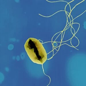 E. coli bacteria strain O157: H7, TEM