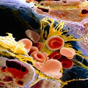 F. colour SEM of macrophage & blood cells in liver