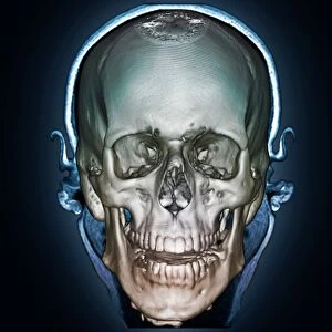 Human skull, 3D CT scan F006 / 9108