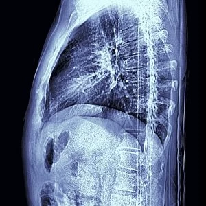 Human torso, MRI scan