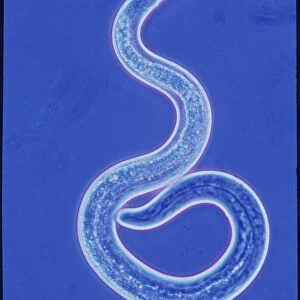 LM of 1st larval stage of dog roundworm