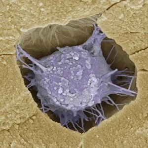 Osteoblast bone cell, SEM