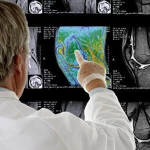 Radiologist examining knee MRI scans C014 / 1300