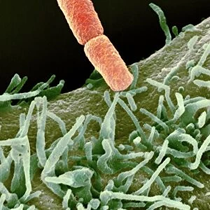 Shigella bacteria, SEM