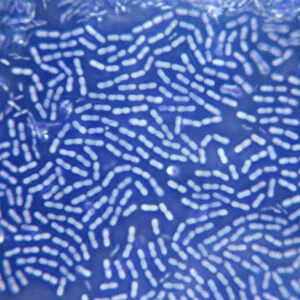 A colony of bacteria seen under a microscope