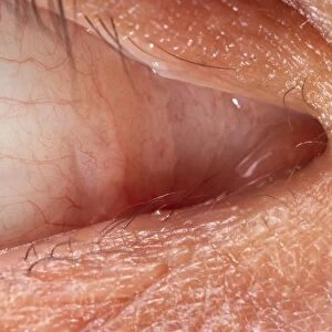 Human eye showing lacrimal gland, close-up