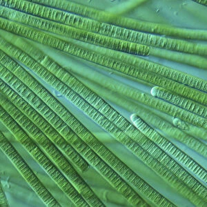 Oscillatoria, light microscope view of cyanobacteria
