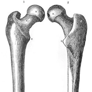 Femur bones anatomy engraving 1857