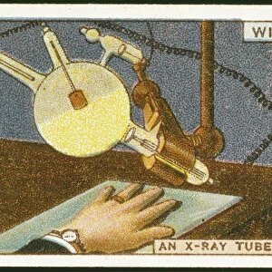 X-raying the hand, 1924
