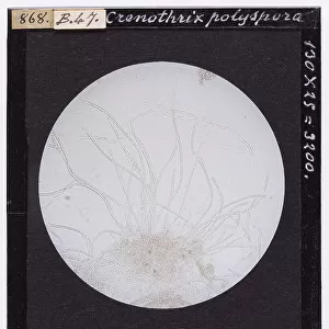 Crenothrix polyspora magnified under the microscope