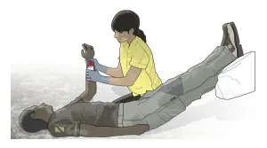 Digital illustration of woman applying pressure to hemorrhaging wrist wound on man in Digital illustration of woman applying pressure to hemorrhaging wrist wound on man in