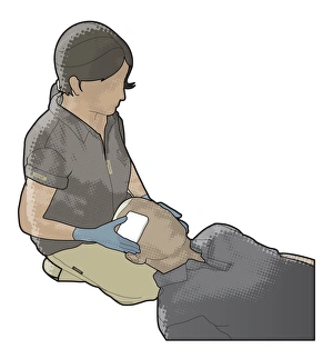 Digital illustration of woman holding sterile gauze on eye of man Digital illustration of woman holding sterile gauze on eye of man
